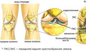 Хруст в колене при ходьбе: почему хрустит коленный сустав