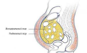 Đặc điểm của béo phì nội tạng ở phụ nữ và nam giới